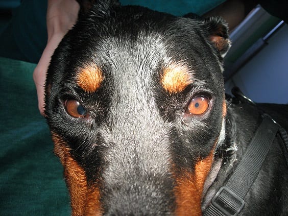anisocoria