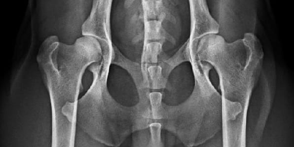 Screening ufficiale displasia dell'anca e del gomito